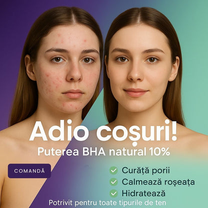 Anti Acnee Serum cu 10% Acid Salicilic BHA - 30 ml